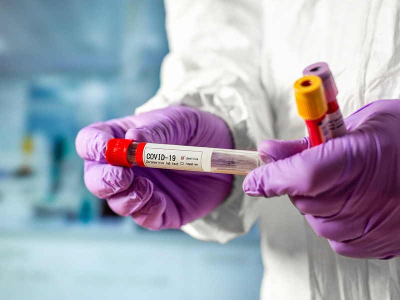 Белгородская область получит почти 15 тысяч доз вакцины от коронавируса